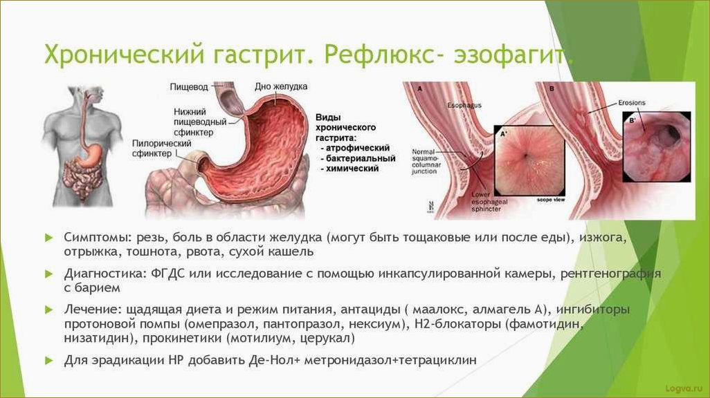 Как уменьшить размеры желудка без хирургического вмешательства и предотвратить неприятные ощущения?