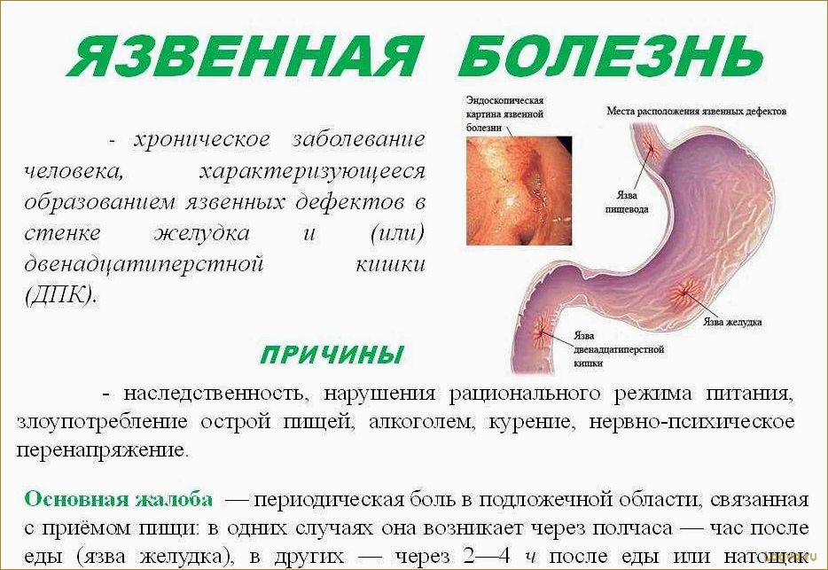 Как уменьшить размеры желудка без хирургического вмешательства и предотвратить неприятные ощущения?