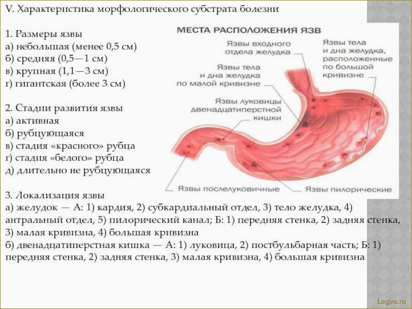 Как уменьшить размеры желудка без хирургического вмешательства и предотвратить неприятные ощущения?