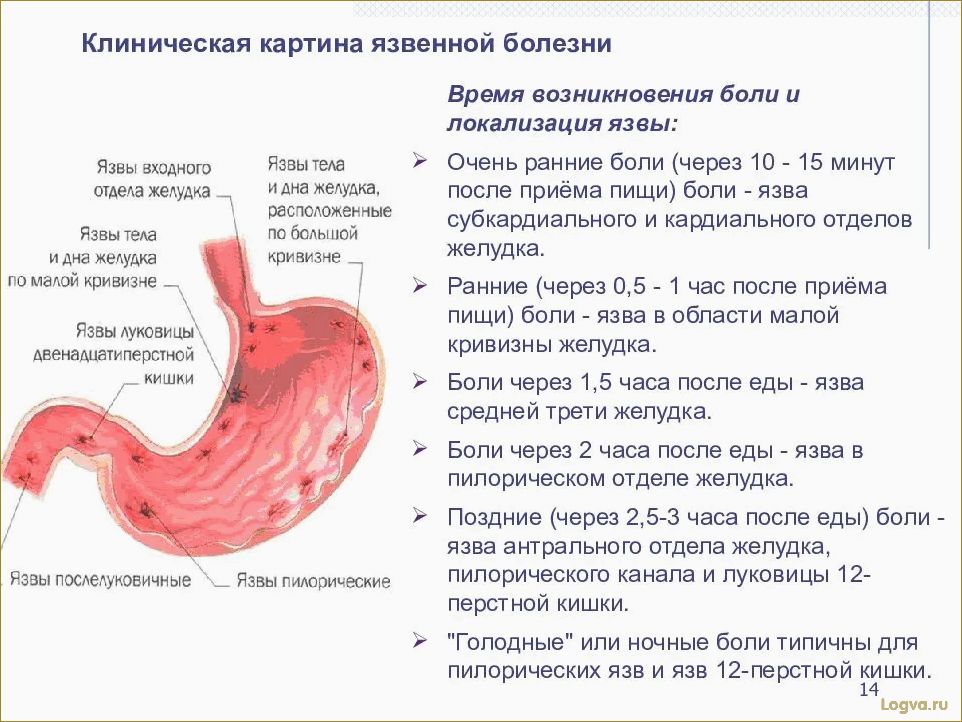 Как уменьшить размеры желудка без хирургического вмешательства и предотвратить неприятные ощущения?