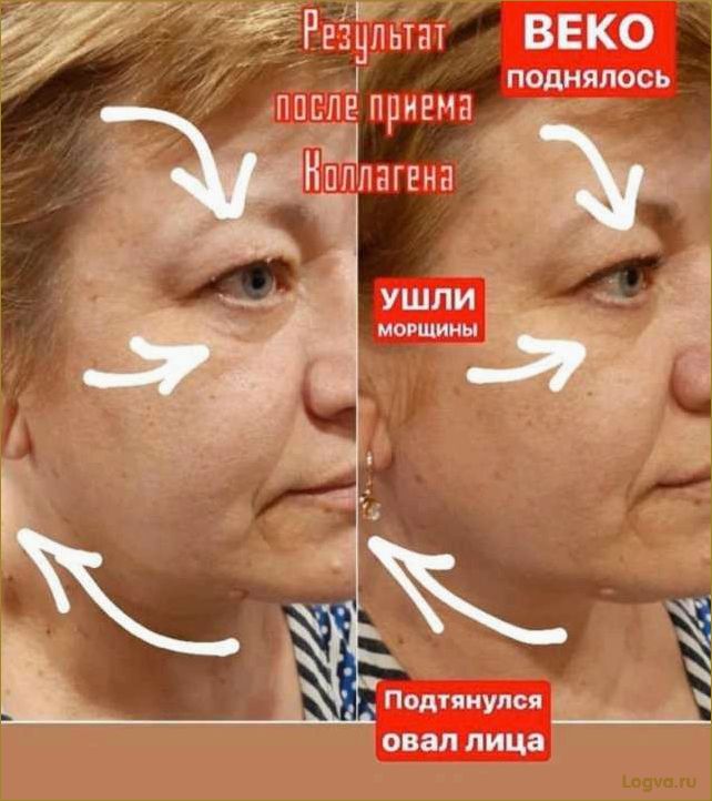 Коллаген — панацея от морщин или миф?