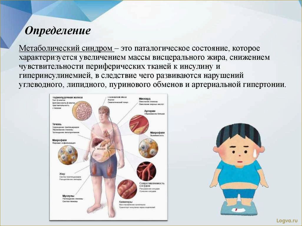 Метаболический синдром. От переедания — к сердечным заболеваниям