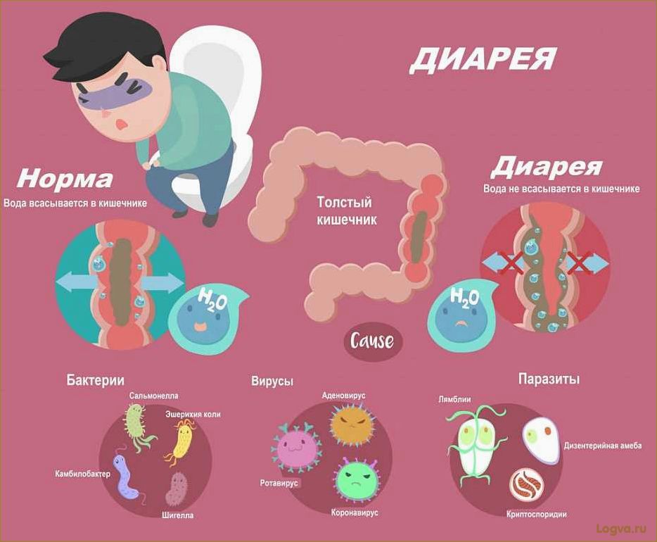 Причины появления дискомфорта в желудке и кишечнике