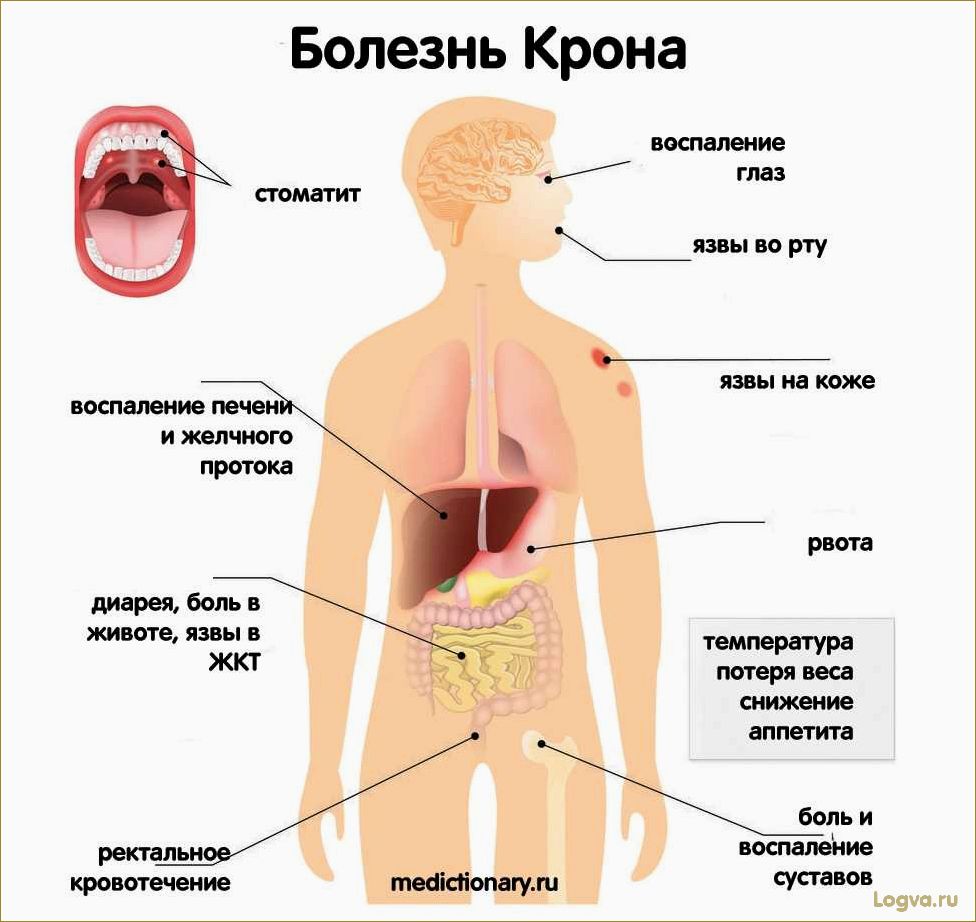 Причины появления дискомфорта в желудке и кишечнике