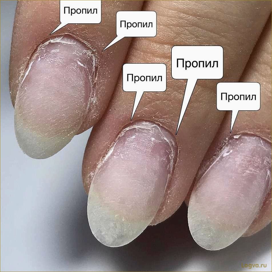 (превратить, ломкие, ногти, маникюр, мечты) Как превратить ломкие ногти в маникюр мечты