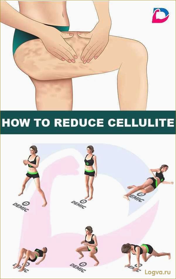 Упражнения от целлюлита