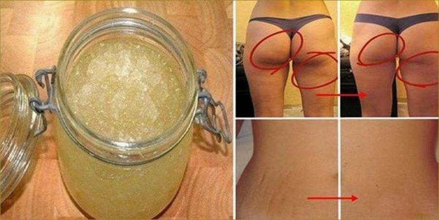 (яблочный, уксус, целлюлита) Яблочный уксус от целлюлита!