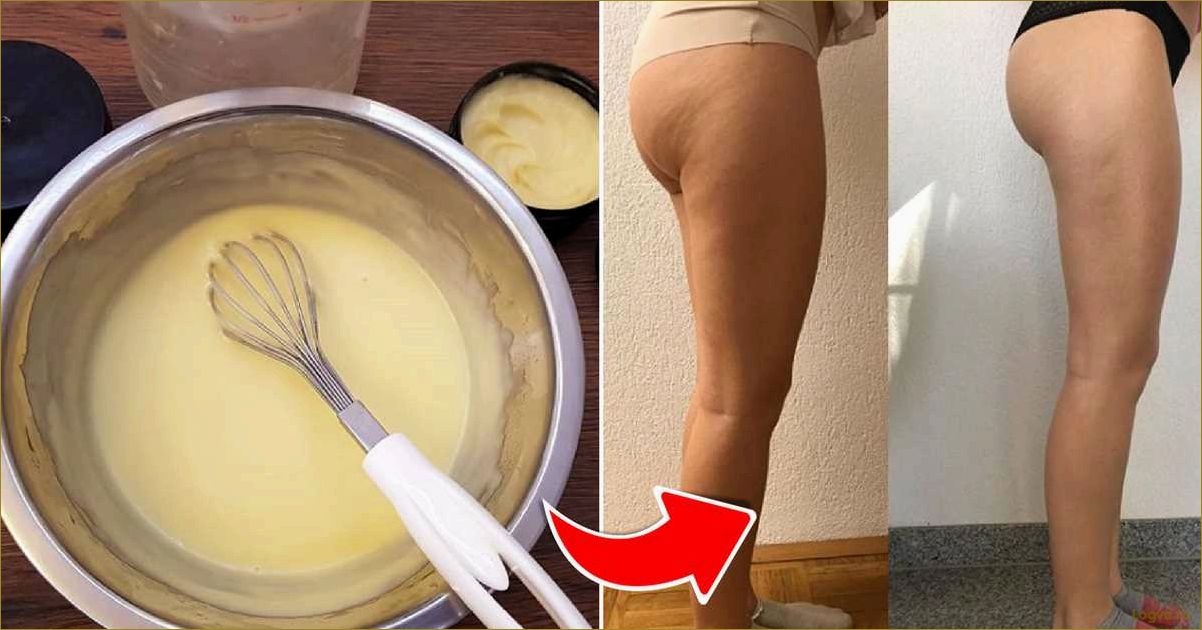 (яблочный, уксус, целлюлита) Яблочный уксус от целлюлита!