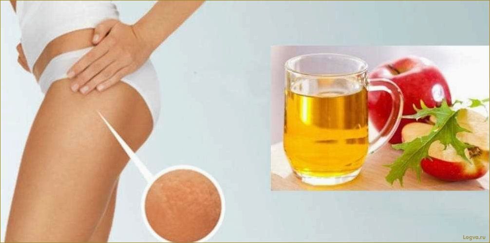 (яблочный, уксус, целлюлита) Яблочный уксус от целлюлита!