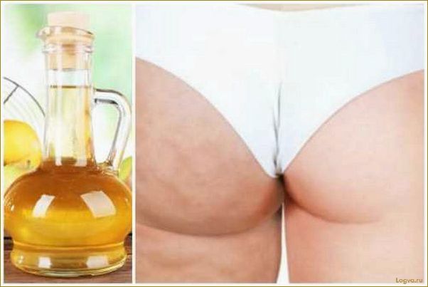 (яблочный, уксус, целлюлита) Яблочный уксус от целлюлита!