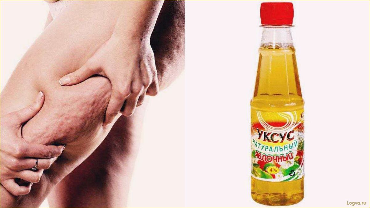 (яблочный, уксус, целлюлита) Яблочный уксус от целлюлита!