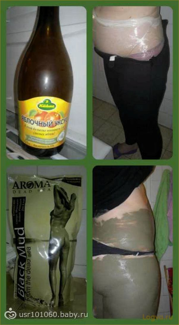 (яблочный, уксус, целлюлита) Яблочный уксус от целлюлита!