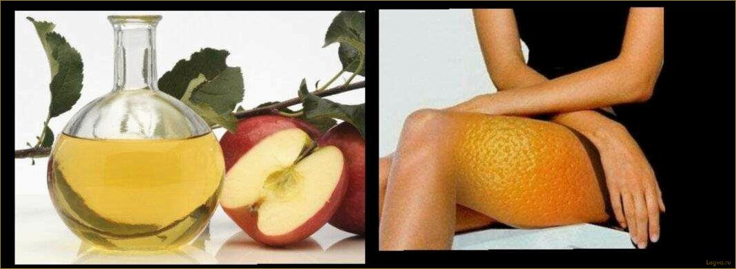 (яблочный, уксус, целлюлита) Яблочный уксус от целлюлита!